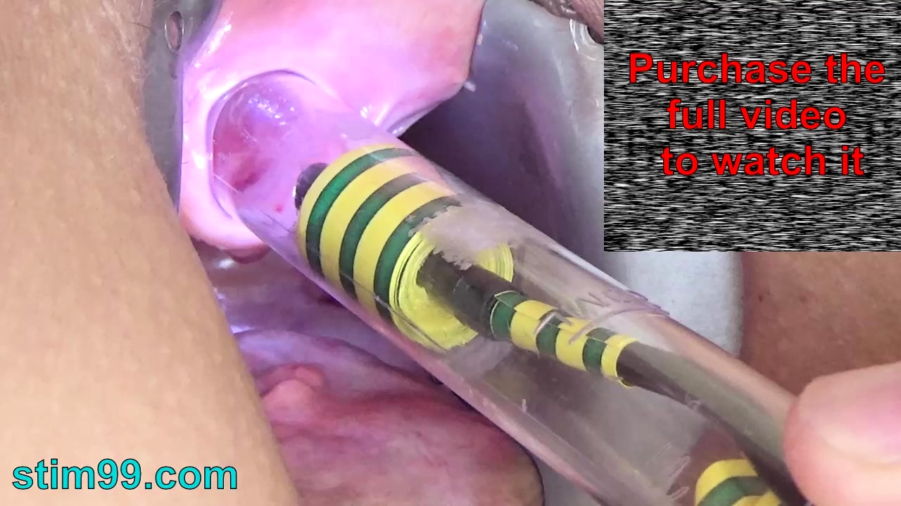 Piss Hole - Woman Pee Hole Playing Urethral Insertion With Endoscope Cam at DrTuber
